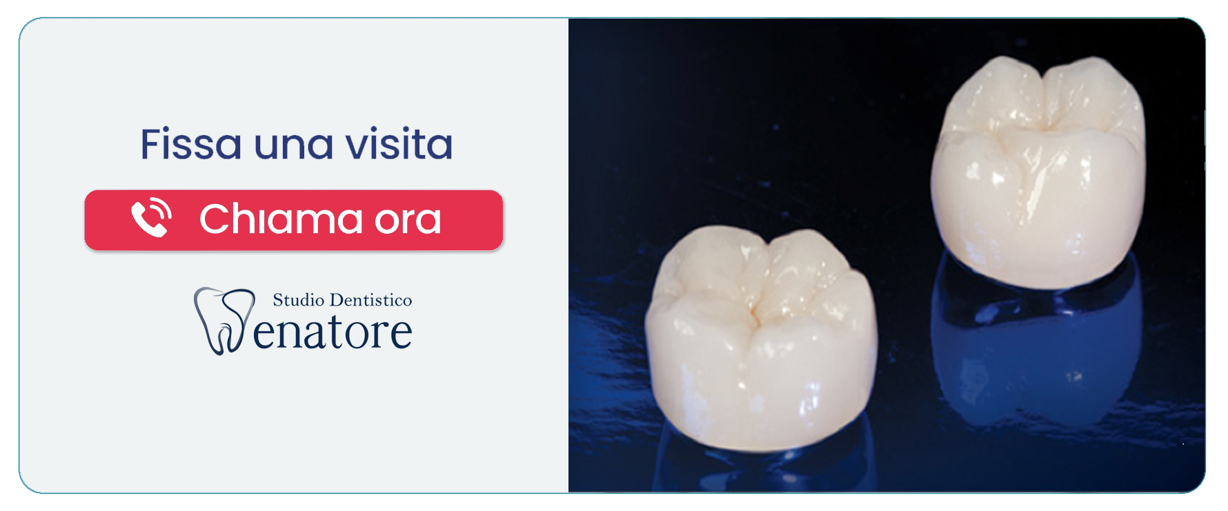 capsule-dentali-metal-free Nocera (Salerno)” width=
