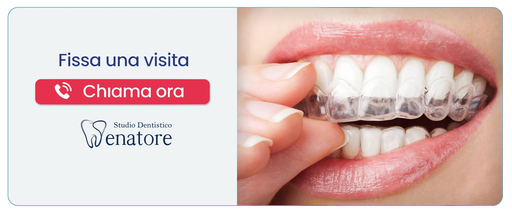 ortodonzia-invisibile (Salerno)” width=