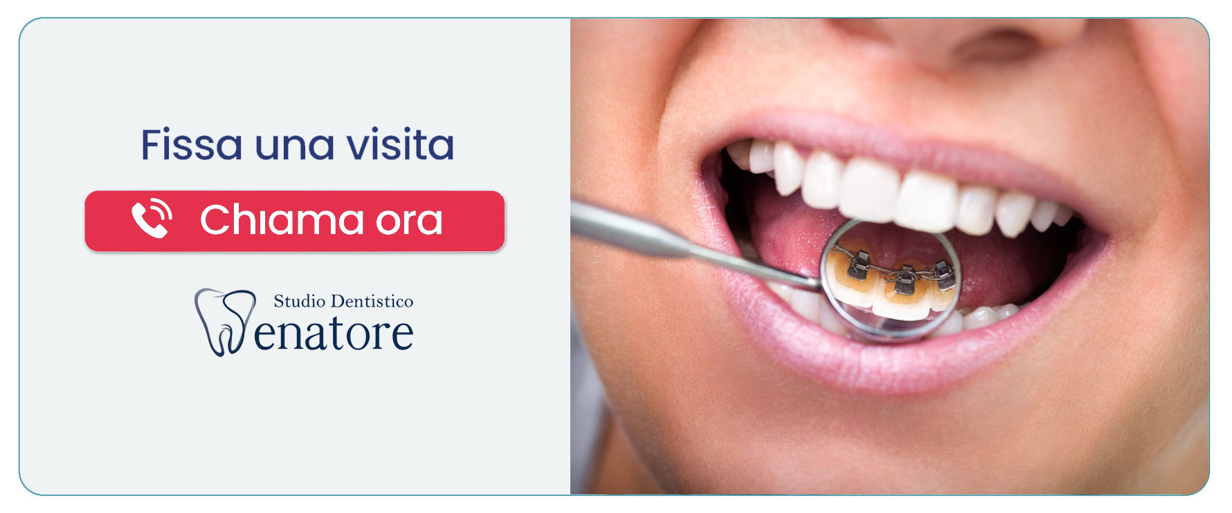 ortodonzia-linguale (Salerno)” width=